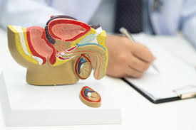 Radical Prostatectomy