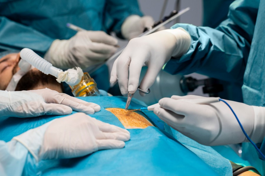 Laparoscopic Urology surgery with surgeons performing a minimally invasive procedure on a patient.